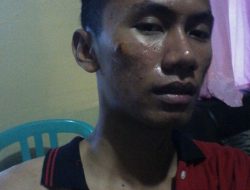 Tiga Warga Sumenep Di Kroyok Preman, Polisi Biarkan Begitu Saja