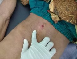 Terhimpit Ekonomi pria asal Kecamatan Batuputih mencoba Bunuh diri