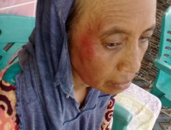Warga Desa Lembung Dilaporkan Ke Polres Sumenep Dugaan Penganiayaan