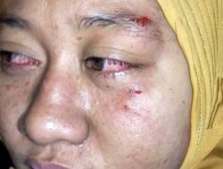 Proses Kasus Penganiayaan, Polsek Giligenting Diduga Main Mata