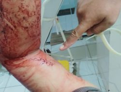 Terlihat Telanjang Keluar Kamar Istri, Warga Kalianget Dibacok Hingga Parah