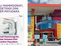 RSUD dr. H Moh Anwar Sumenep Lengkapi Alat Pendeteksi Penyakit Kanker Payudara